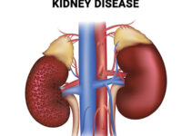 Six Major Causes of Kidney Disease